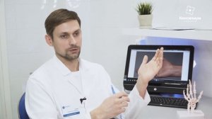 ВЫПРЯМЛЕНИЕ ПАЛЬЦА ЗА ЧАС. КОНТРАКТУРА ДЮПЮИТРЕНА. ОПЕРАЦИЯ В АСТРАХАНИ.