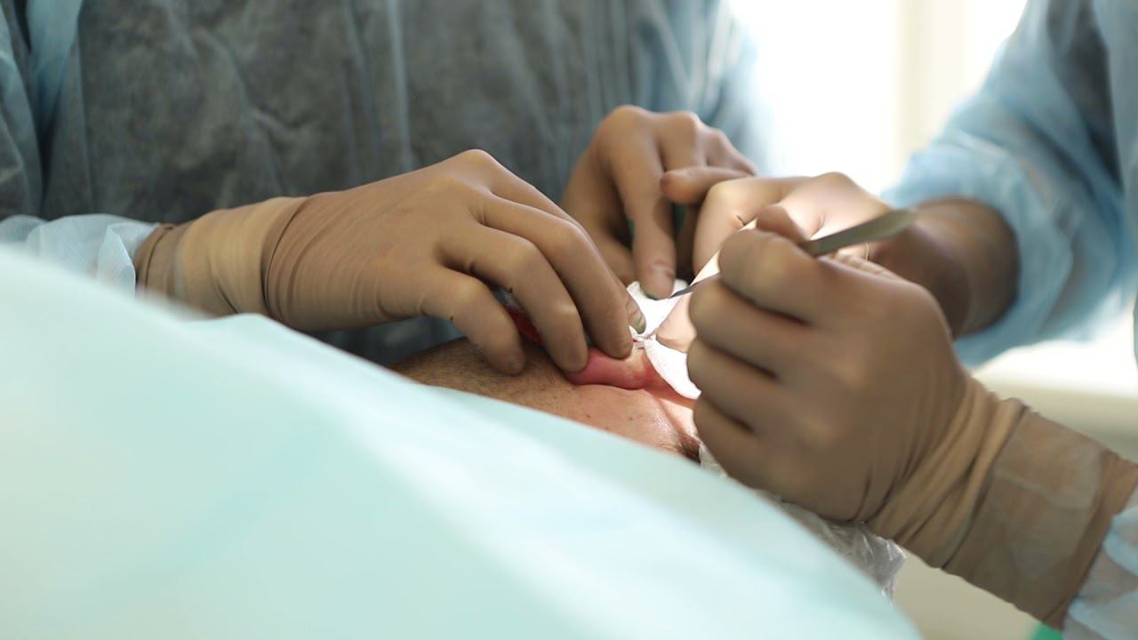 Отопластика. Хирург - Гуляев А.В. Часть 1. смотреть онлайн