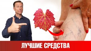 Варикоз на ногах и сосудистые звездочки? Средство от варикоза №1👍