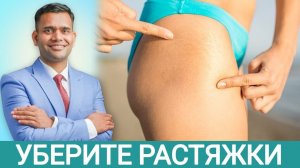 Как Удалить Растяжки После Родов?