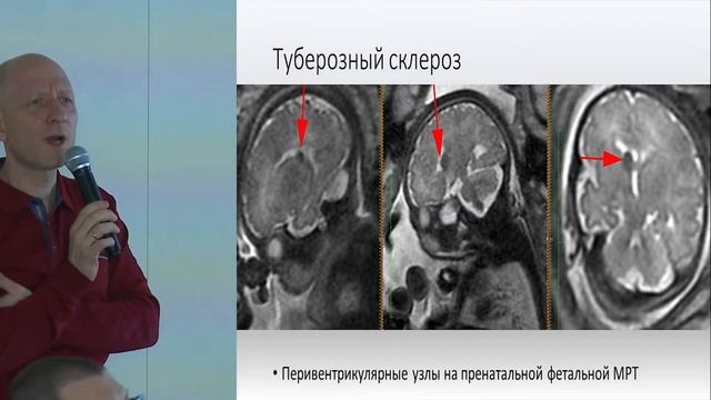 МРТ в диагностике патологии плода и плаценты смотреть онлайн
