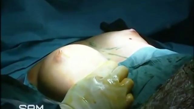 Reportage Plastische Chirurgie: Brustvergrößerung und Brustverkleinerung in Hamburg