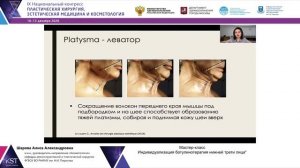 Мастер-класс: Индивидуализация ботулинотерапии нижней трети лица