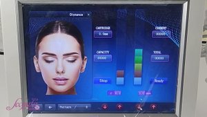 Мастер-класс на аппарате сфокусированного ультразвука 2 в 1 SMAS +Liposonic SA R6 | Scopula.ru