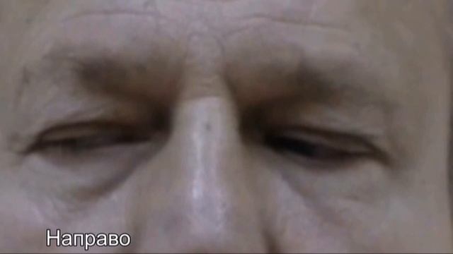 Энцефалопатия Вернике-Корсакова смотреть онлайн