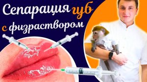 Сепарация губ с физраствором