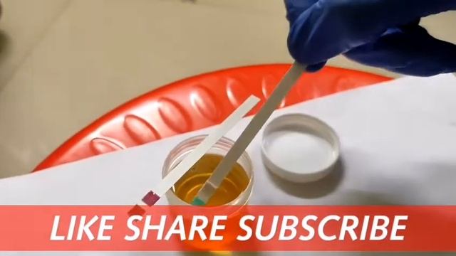 URINE KETONE DIPSTICK METHOD смотреть онлайн