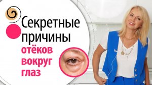 ОТЁКИ И МЕШКИ под глазами: НЕОЖИДАННЫЕ причины и одна полезная техника