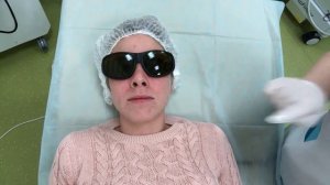 Лазерное омоложение лица. Видео процедуры до и после.