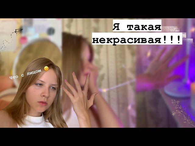 Я такая некрасивая!!! Как влияет общество| Sofi Engeleva