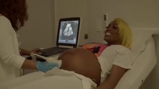 LaToya Jane doing a 3D Ultrasound for her Baby!!! Surprise🎉🎈#pregnancy #prenatal #3dultrasound