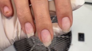 ФРЕНЧ ПОТАЛЬЮ | КРЕАТИВНЫЙ ДИЗАЙН | УКРЕПЛЕНИЕ ГЕЛЕМ | ОНИХОЛИЗИС