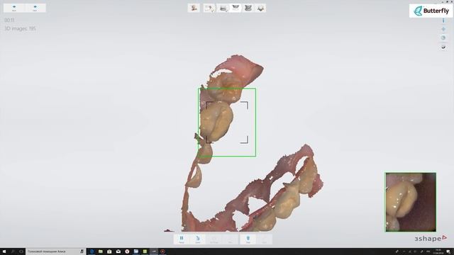 SCANNING 3Shape TRIOS 3 WIRELESS