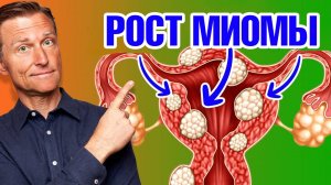 Как уменьшить миому матки? Самый эффективный способ!🙌