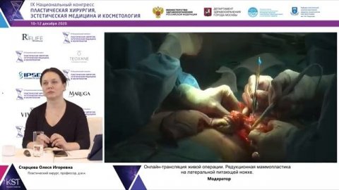 Трансляция живой операции: Редукционная Маммопластика на латеральной питающей ножке