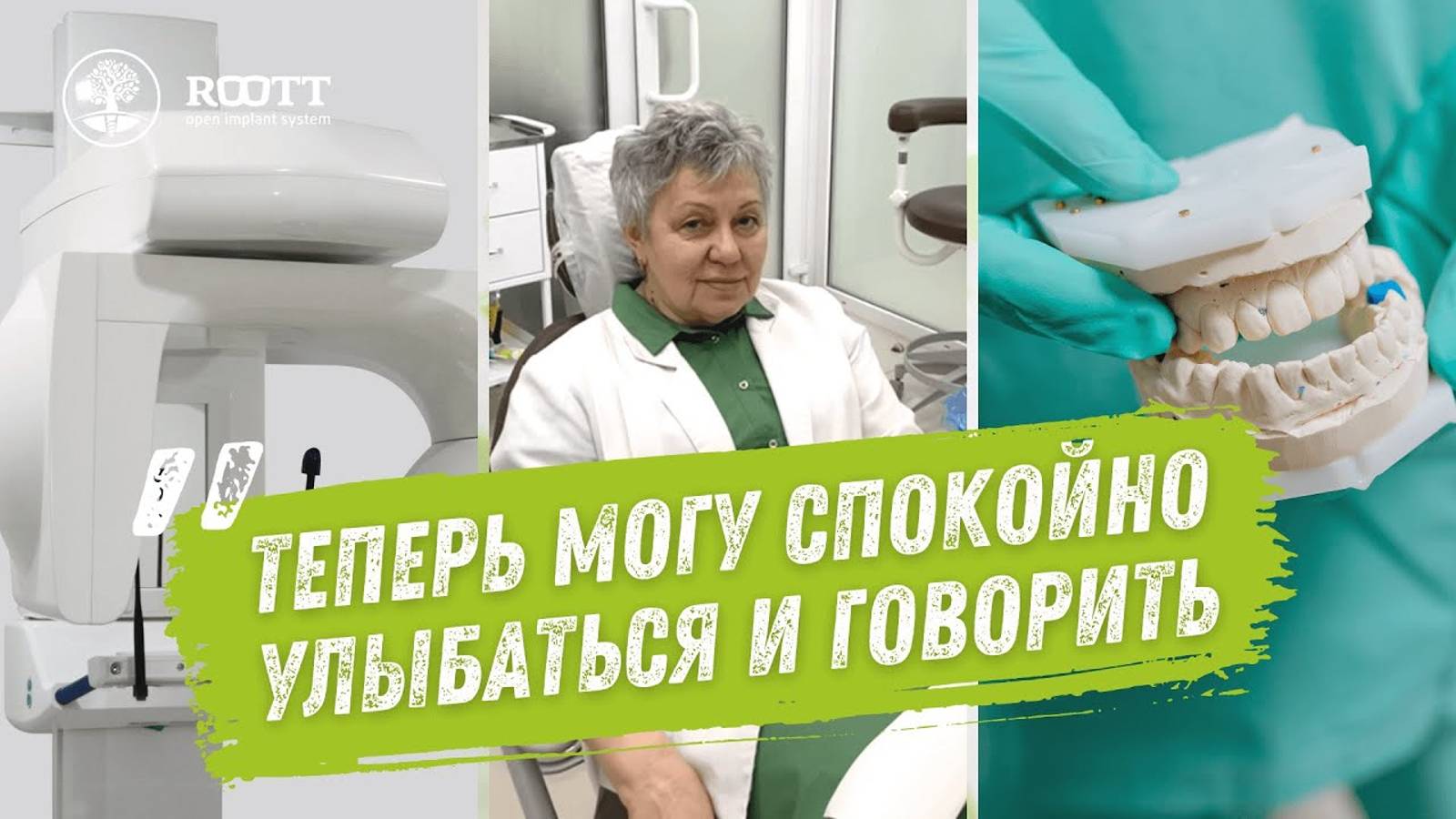 Благодарим Людмилу Алексеевну за теплый отзыв о комплексной имплантации 🦷