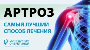Лучший метод ЛЕЧЕНИЯ АРТРОЗА | Как убрать БОЛЬ в СУСТАВАХ?