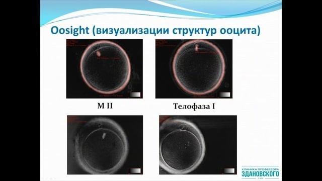 Эмбриологический этап программы ЭКО