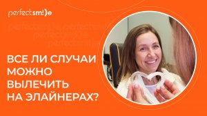 👋 Все ли клинические случаи поддаются лечению на элайнерах?