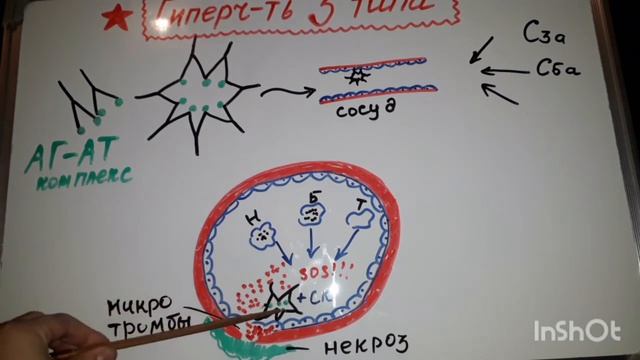 гиперчувствительность з типа (патогенез)