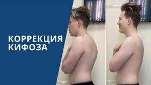 Лечение кифоза позвоночника