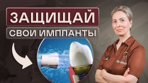 Защищай свои импланты. Значение профгигиены