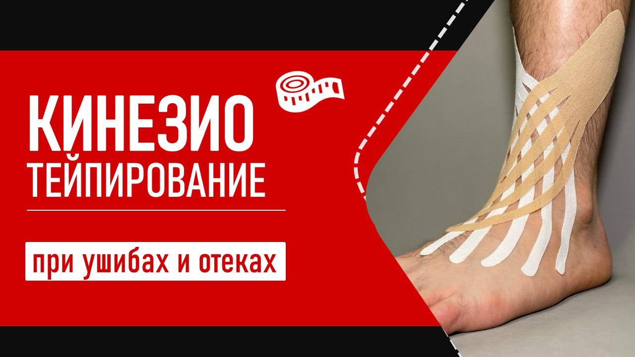 Кинезиотейп при ушибах и отеках | Пошаговая инструкция