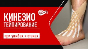 Кинезиотейп при ушибах и отеках | Пошаговая инструкция