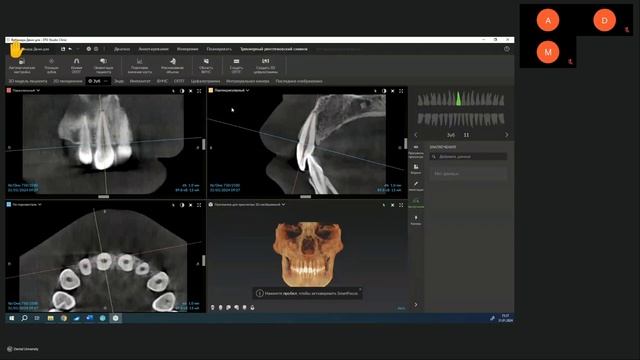 Вебинар DEXIS Инновационное ПО DTX Studio Clinic с интеллектуальным помощником в практике