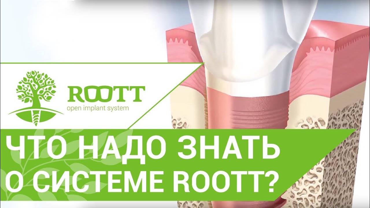 Узнайте о системе имплантации премиум-класса по доступной цене! ROOTT