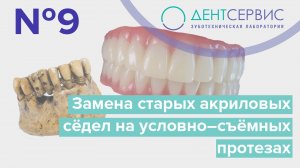 Замена старых акриловых сёдел на условно–съёмных протезах