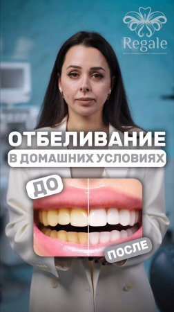 Возможно ли отбелить зубы в домашних условиях? #отбеливаниезубов #стоматолог  #вопросответ