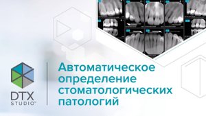 Автоматическое определение стоматологических патологий | DTX Studio Clinic
