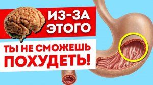 Причины всех болезней кишечника кроются в ЭТОМ! /Как восстановить микрофлору кишечника без таблеток