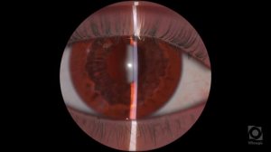 Щелевая лампа. ВИРТУМЕД // Eyesi Slit Lamp. VIRTUMED