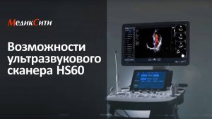 Ультразвуковой сканер HS60 (Samsung Medison). Клиника "МедикСити"