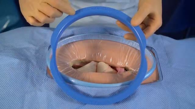 Протектор раны SurgiSleeve смотреть онлайн