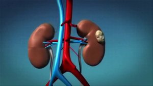 Самовнушение - иллюзия исцеления