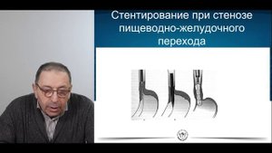 Осложненные формы онкологических заболеваний. Фридман М.Х.
