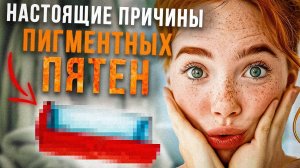 ПИГМЕНТНЫЕ ПЯТНА И ГОРМОНЫ. КАК УБРАТЬ ПИГМЕНТ? КАК УЛУЧШИТЬ КОЖУ?