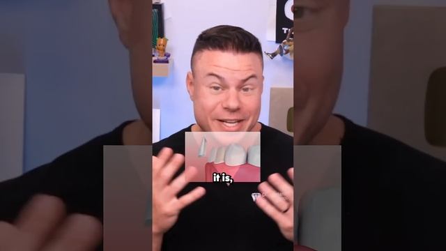 When You Can’t Pay For Your Veneers смотреть онлайн