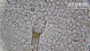 Угревая Железница Demodex | Как мазь Оксолин убивает клеща