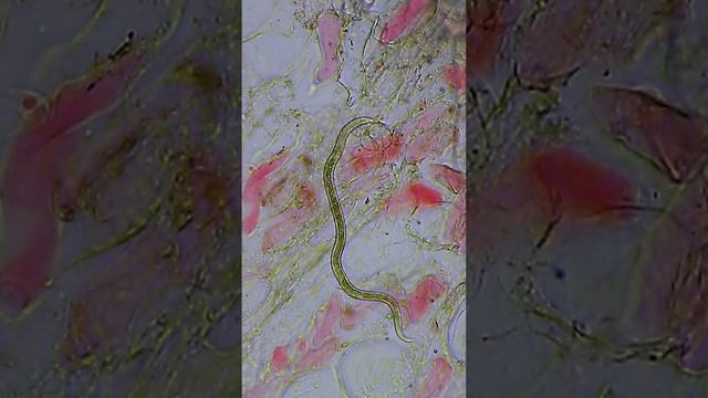 Осторожно ⚠⚠⚠ ЧЕРВИ в инжире смотреть онлайн