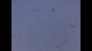 Удивительный мир в капле воды из лужи под микроскопом. Микробы и бактерии под микроскопом.