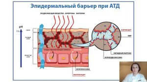 Максимова_Атопический дерматит