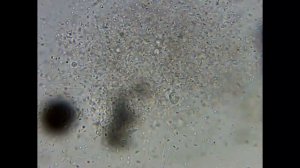 Колония бактерий под микроскопом - Капля воды из озера