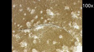 Йогурт под микроскопом - Живые бактерии в Actimel