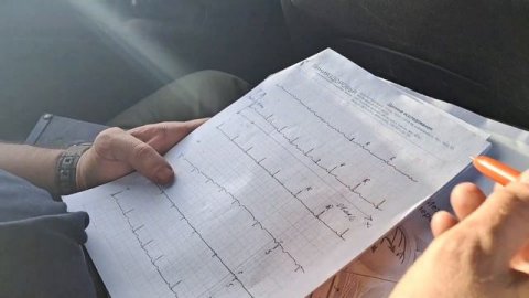 Кардиограмма. ЭКГ. Лекция кардиолога. Жизнь клапанщика