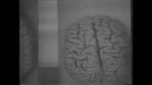 Азербайджанский Медицинский Университет - анатомический музей,1993