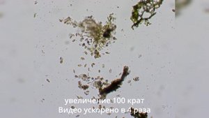 Спирт и перекись водорода - что лучше справляется с микробами?